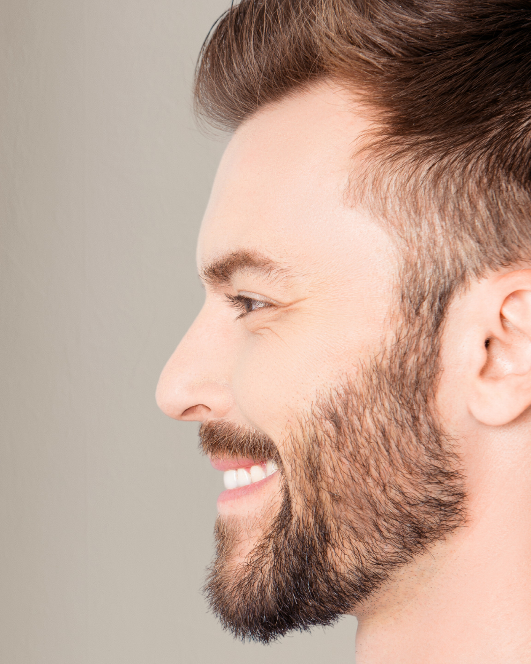 Implante de Barba FUE
